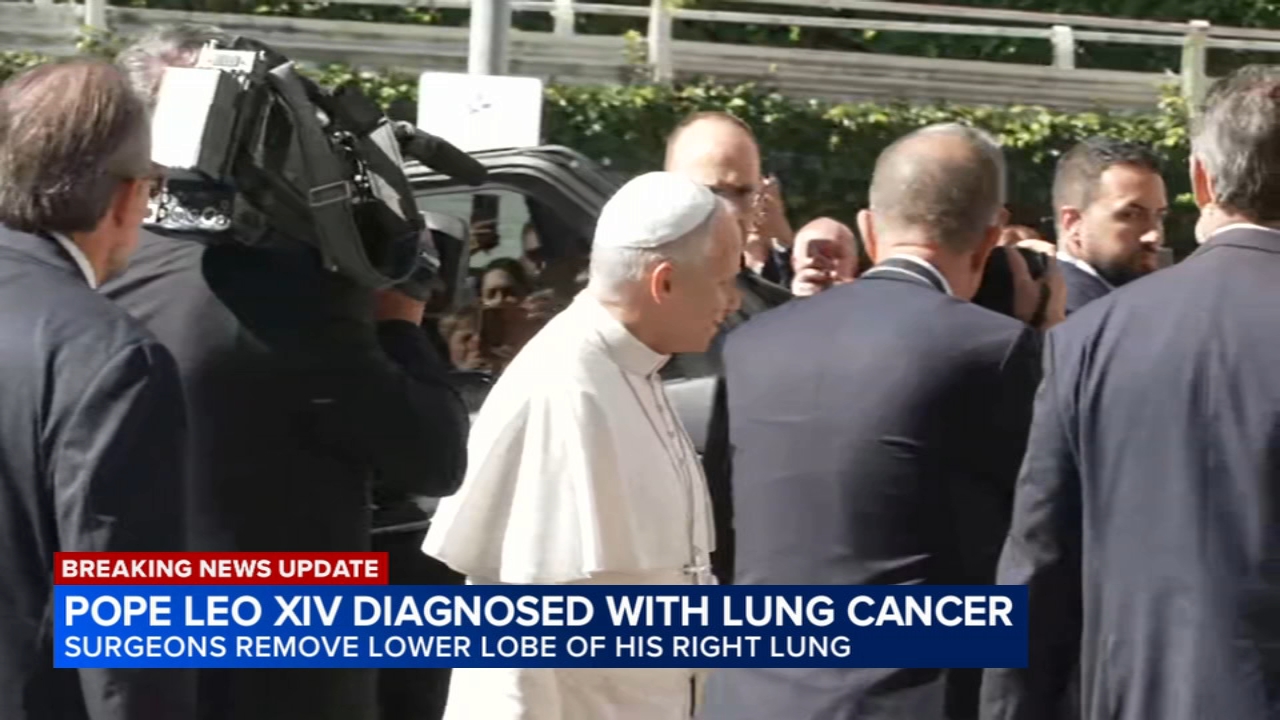 Pope surgery update: Vatican says Pope Leo XIV has lung cancer and the lower lobe of his right lung was removed
       — ABC 7 Bay Area, Healdsburg Community news