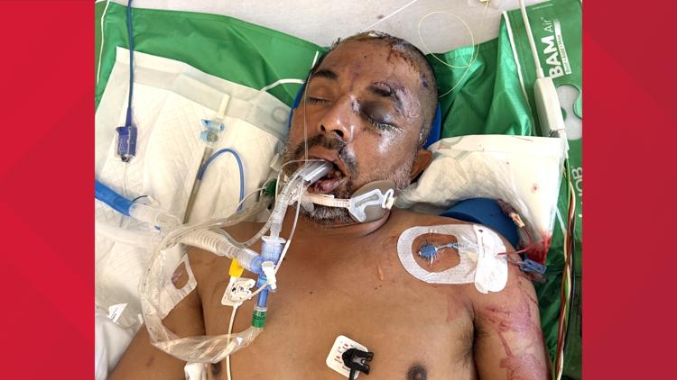University Hospital asks for help identifying unconscious patient hit by truck Saturday evening — KENS 5 (San Antonio), Healdsburg Health news