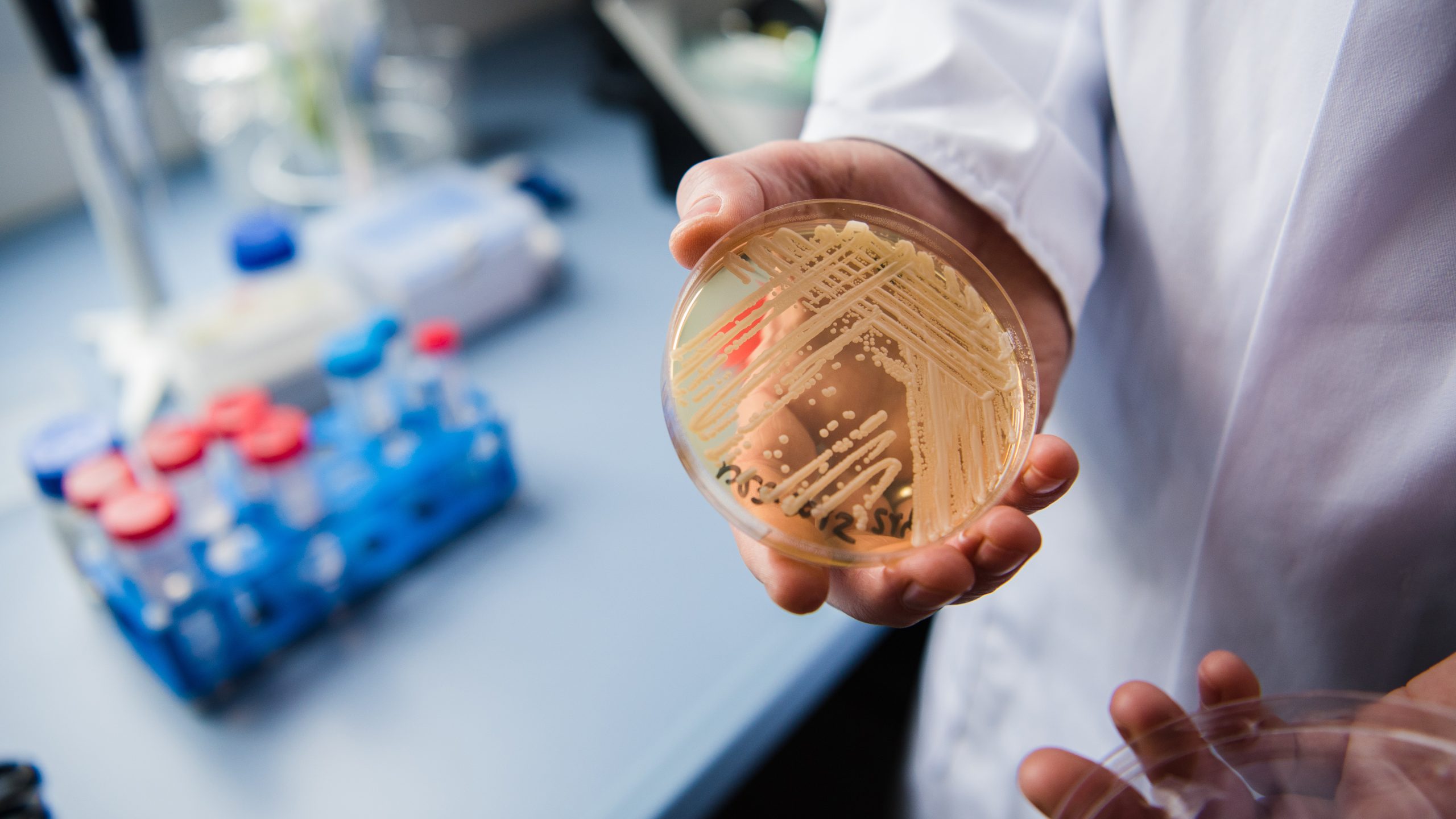 New study reveals why dangerous fungus is so difficult to treat — KTVU FOX 2 Bay Area, Healdsburg Community news
